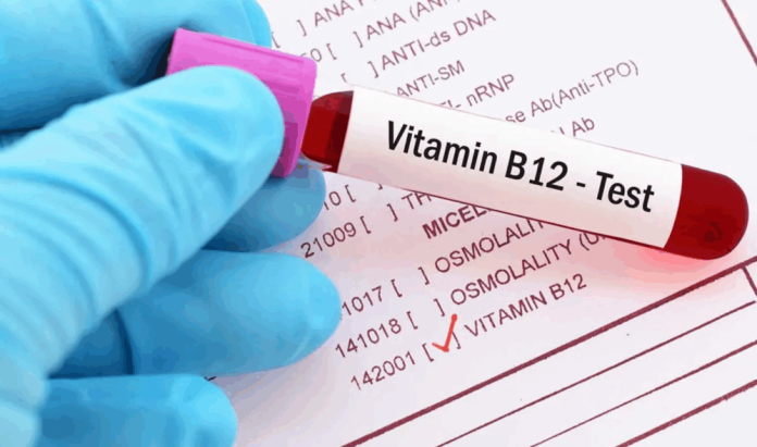 Дефіцит вітаміну B12 може призвести до незворотних уражень нервів — лікарі назвали тривожні симптоми